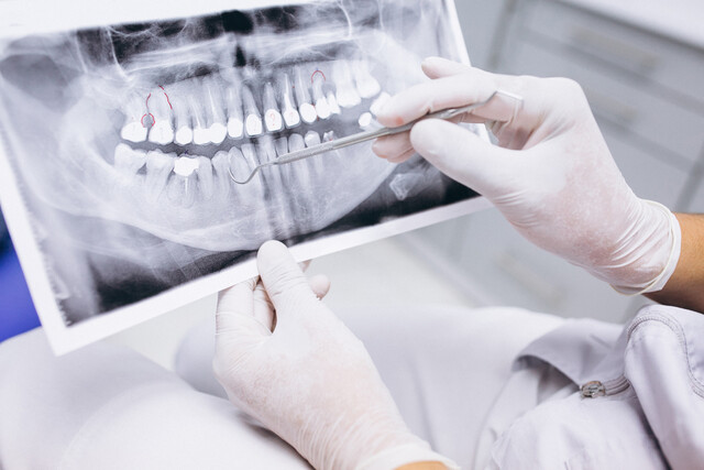 x-ray-teeth.jpg
